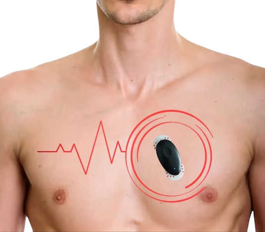 Holter test